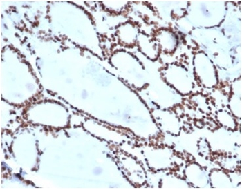 HOXB2 (Transcription Factor) Antibody