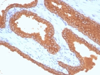 KLK3 Antibody