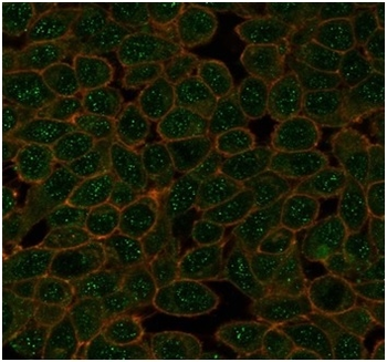 GTF2A1 Antibody