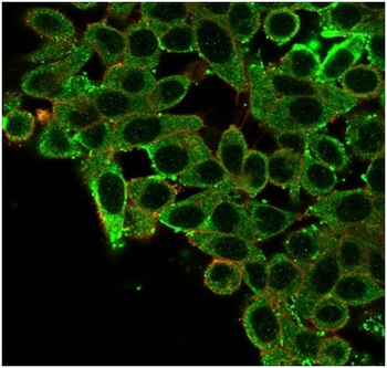 CCR4-NOT transcription complex, subunit 10 (CNOT10) Antibody