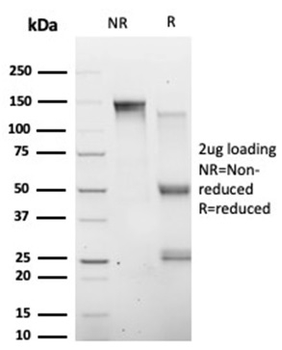 HIC2 (Hypermethylated in cancer 2) (Transcriptional Repressor) Antibody