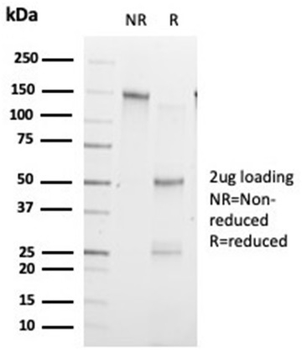 ZHX3 (Transcriptional Repressor) Antibody