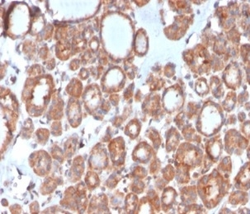 Calcitonin Antibody