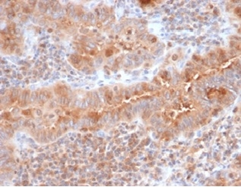 Calcitonin Antibody