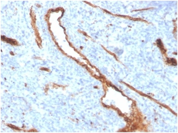 VWF Antibody