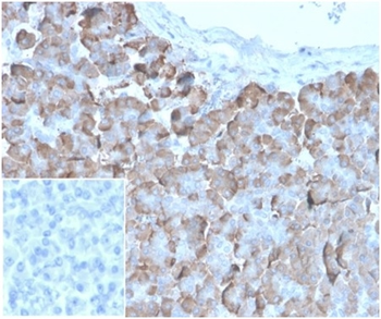 Recombinant VLDL-Receptor (Very Low Density Lipoprotein Receptor) Antibody