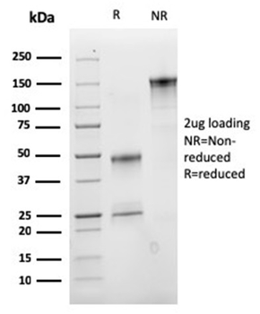 Recombinant VLDL-Receptor (Very Low Density Lipoprotein Receptor) Antibody