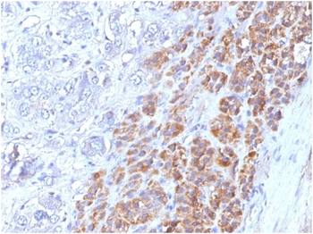Interleukin-25 (IL-25) / IL-17E Antibody