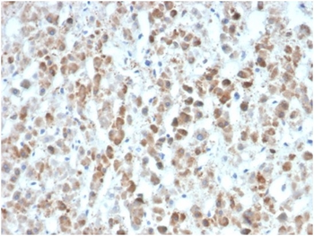 Interleukin-25 (IL-25) / IL-17E Antibody