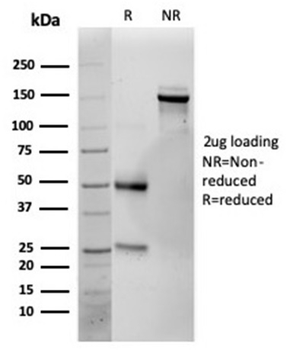 Interleukin-25 (IL-25) / IL-17E Antibody