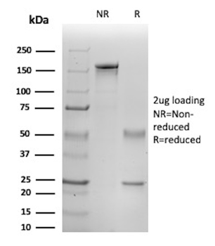 Interleukin-1beta (IL-1beta) Antibody
