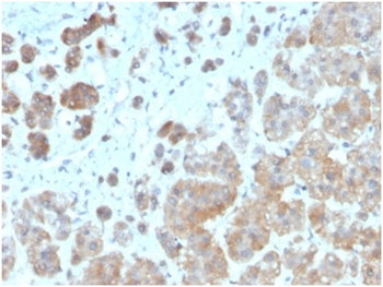 Interleukin-1beta (IL-1beta) Antibody