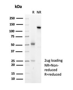 Recombinant Heat Shock 27kDa Protein 1 Antibody