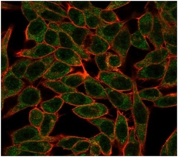 BCL6 Antibody