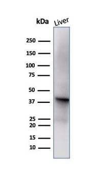 Glutamine Synthetase / GLUL Antibody