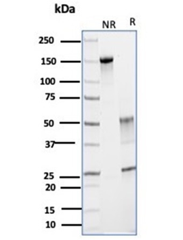 Glutamine Synthetase / GLUL Antibody