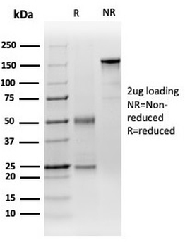 DCP2 (Decapping mRNA 2) Antibody