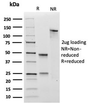 Transglutaminase II (TGM2) (FN Binding Domain) Antibody