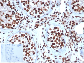 Integrase interactor 1 (INI-1) / SNF5 / SMARCB1 Antibody