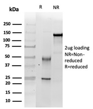 Integrase interactor 1 (INI-1) / SNF5 / SMARCB1 Antibody