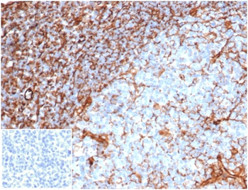 Recombinant Vimentin (Mesenchymal Cell Marker) Antibody