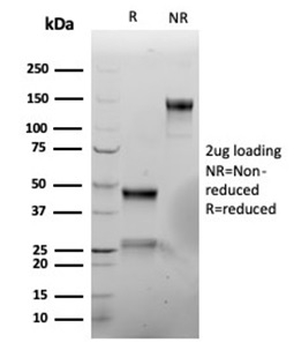 Recombinant Vimentin (Mesenchymal Cell Marker) Antibody