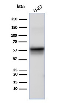 Recombinant Vimentin (Mesenchymal Cell Marker) Antibody