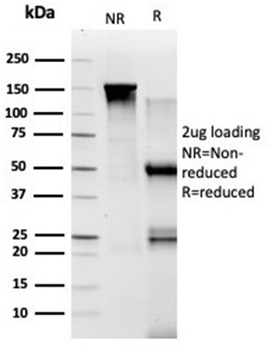 TADA1 (Transcriptional Adapter 1) / STAF42 Antibody
