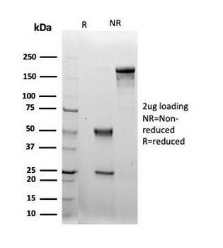 LRG1 / Leucine Rich alpha-2-glycoprotein 1 Antibody