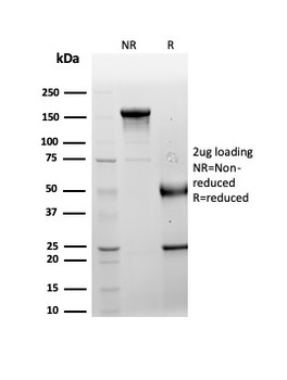 LRG1 / Leucine Rich alpha-2-glycoprotein 1 Antibody