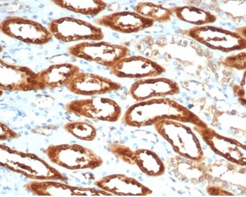 Creatine Phosphokinase-BB (CK-BB) Antibody