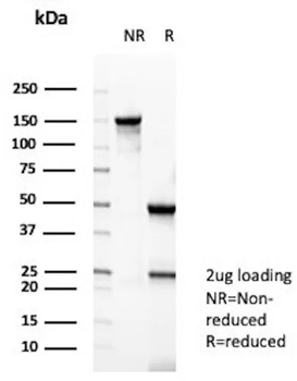 Creatine Phosphokinase-BB (CK-BB) Antibody