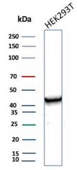 Creatine Phosphokinase-BB (CK-BB) Antibody
