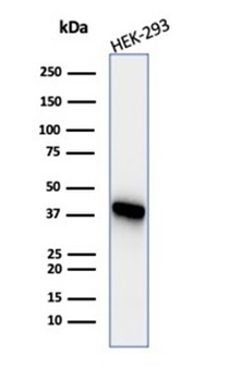 Creatine Phosphokinase-BB (CK-BB) Antibody