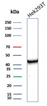 Creatine Phosphokinase-BB (CK-BB) Antibody