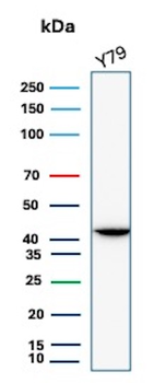 Creatine Phosphokinase-BB (CK-BB) Antibody