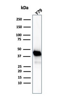 Creatine Phosphokinase-BB (CK-BB) Antibody