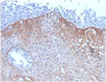 FGF23 Antibody