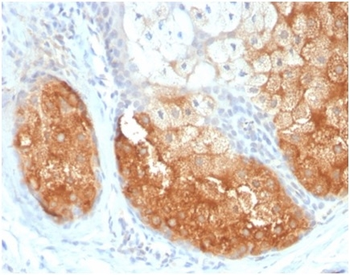 Tyrosinase (Melanoma Marker) Antibody