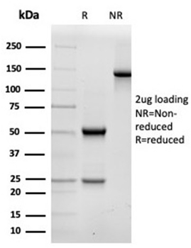 Fodrin / Alpha Spectrin II (SPTAN1) / NEAS Antibody