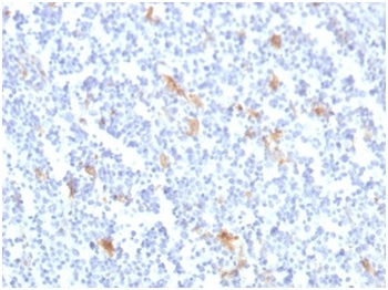 SPARC / Osteonectin Antibody