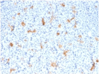 SPARC / Osteonectin Antibody