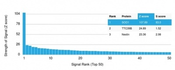 Superoxide Dismutase 1 (SOD1) (Antioxidant Enzyme) Antibody