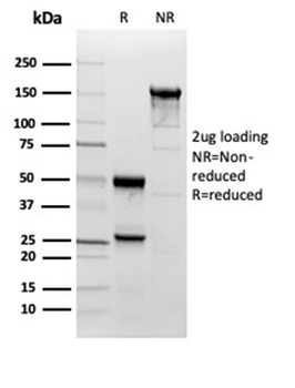Superoxide Dismutase 1 (SOD1) (Antioxidant Enzyme) Antibody