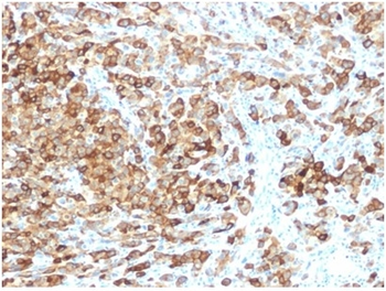 Recombinant gp100 / Melanosome / PMEL17 / SILV (Melanoma Marker) Antibody