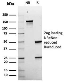 Recombinant gp100 / Melanosome / PMEL17 / SILV (Melanoma Marker) Antibody