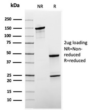 Recombinant Sex Hormone Binding Globulin (SHBG) Antibody