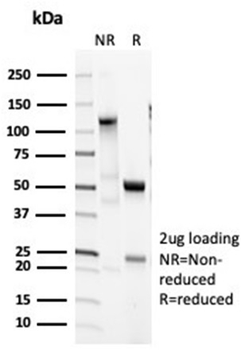 SFTPD Antibody