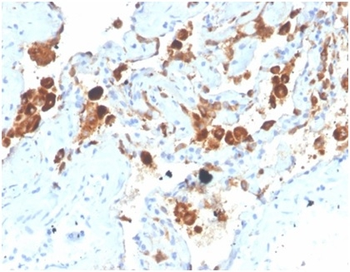 Pulmonary Surfactant-Associated Protein D (SFTPD) Antibody
