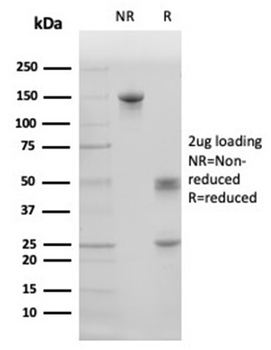Pulmonary Surfactant-Associated Protein D (SFTPD) Antibody